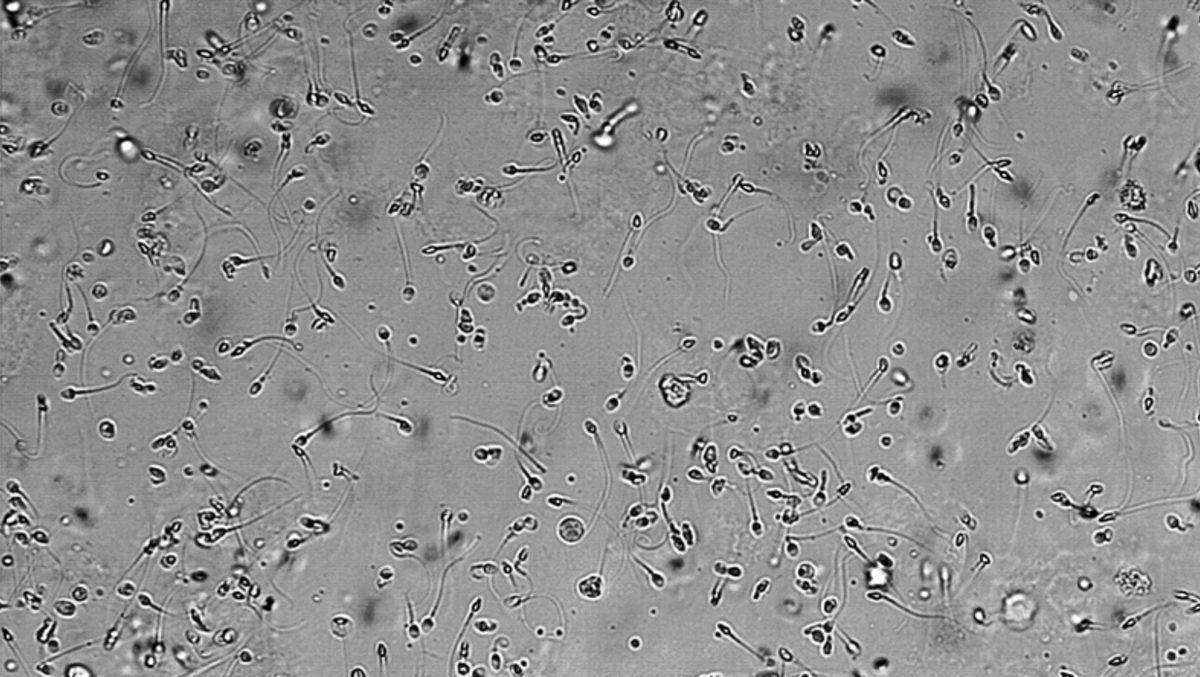 Sırt Ağrısı İçin Kendi Spermini Vücuduna Enjekte Eden Adam Hastaneye Kaldırıldı