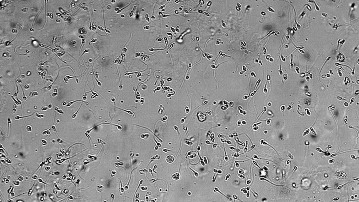 Sırt Ağrısı İçin Kendi Spermini Vücuduna Enjekte Eden Adam Hastaneye Kaldırıldı