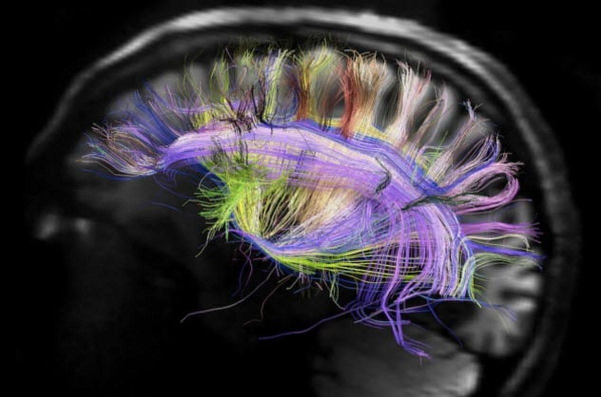 Hafıza İle İlgili Çoğu Kişinin Bilmediği 8 Garip Şey