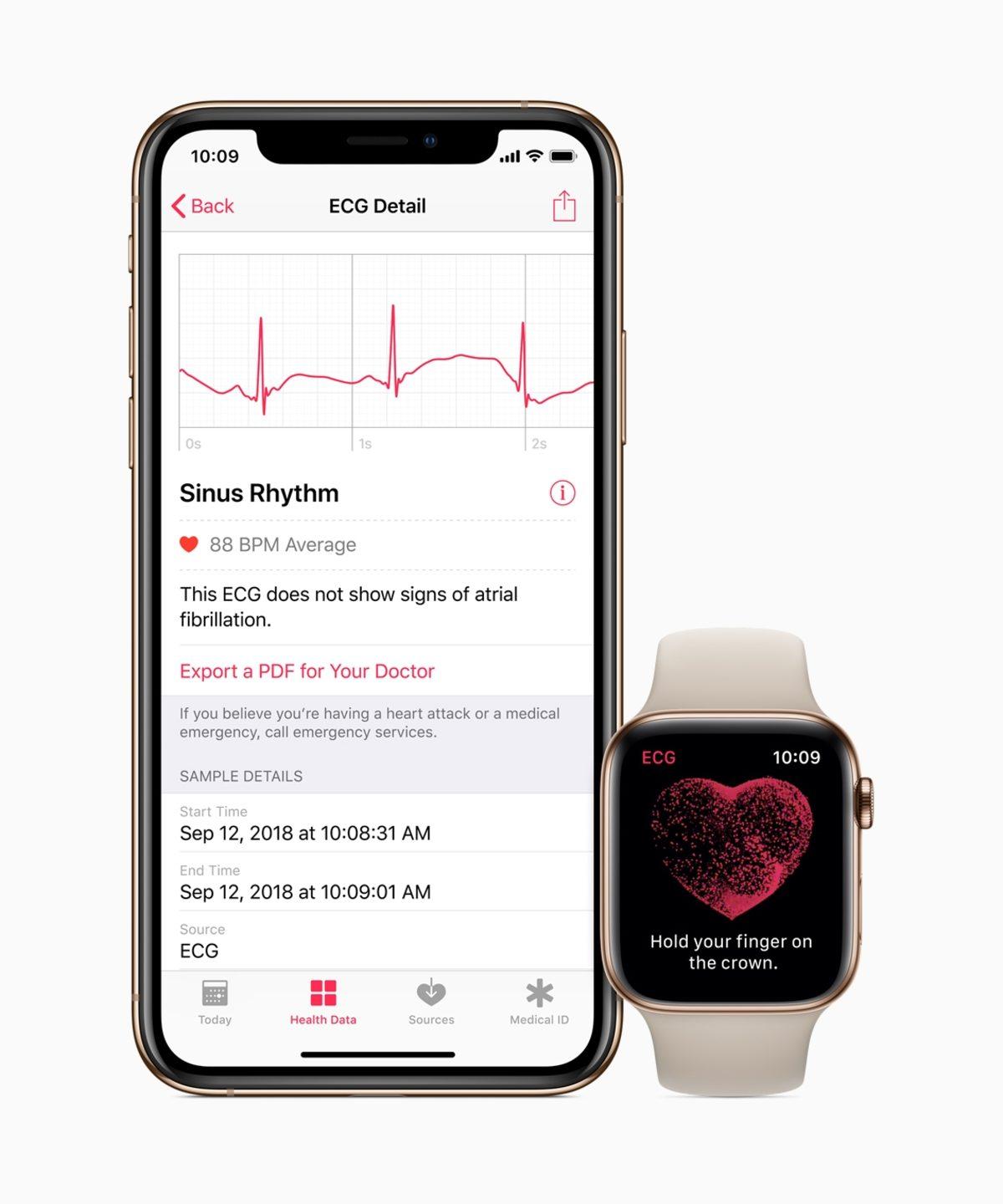 Bir Kullanıcı, Apple Watch’un EKG Uygulaması Sayesinde Kalp Rahatsızlığını Keşfetti