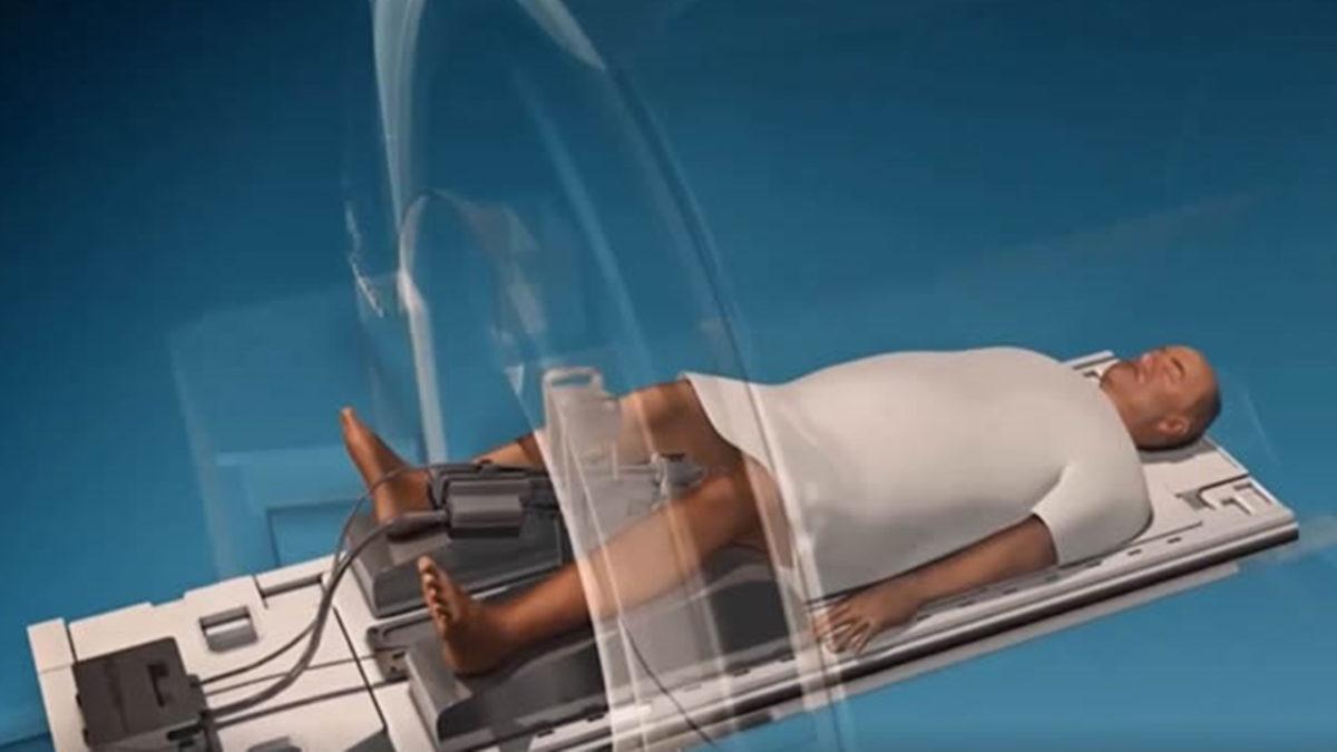 Yeni Tedavi Yöntemi ile Prostat Kanserli Katılımcıların Yüzde 80’i Tedavi Edildi