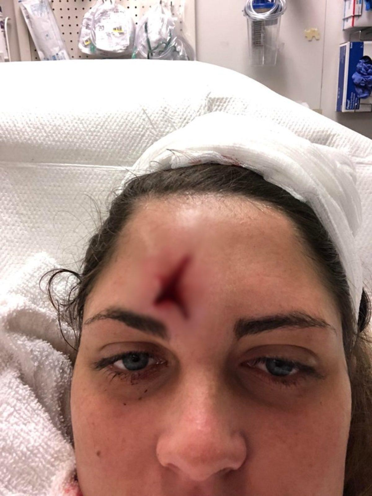 Bir Kadını Golf Topuyla Yaralayan Sony Çalışanı, Kadını Hediyelere Boğdu