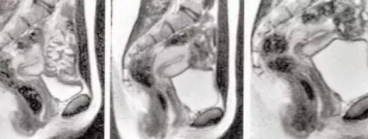 20 Yıl Önceki İlginç Cinsel Araştırma Tekrardan Gündeme Geldi