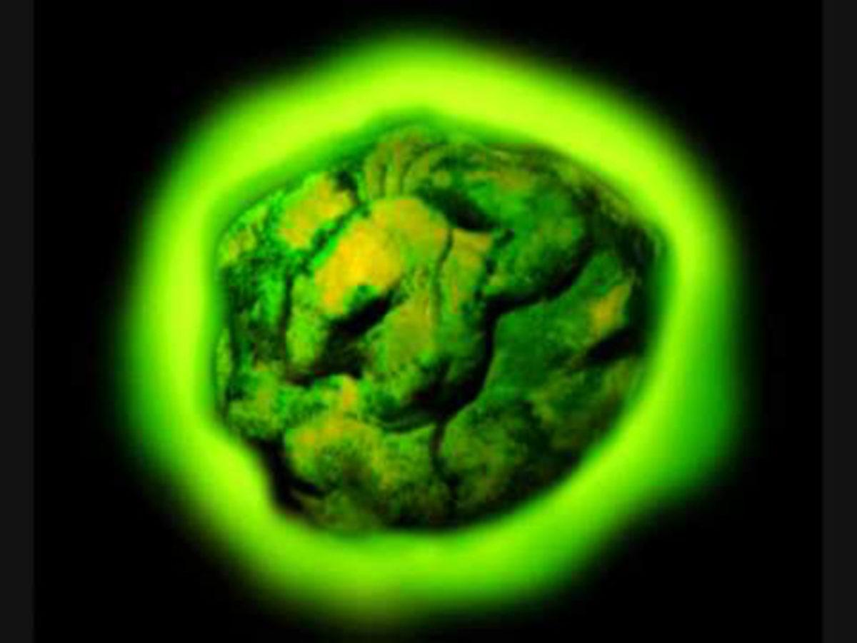 Dünyanın En Radyoaktif Maddesi Radyum’un Keşfi