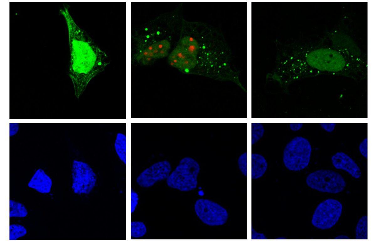 Bilim İnsanlarından Hepatit D Virüsüyle İlgili Önemli Buluş