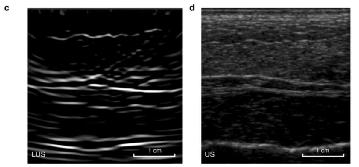 MIT, Temasa İhtiyaç Duymayan Yeni Bir Lazer Ultrason Teknolojisi Geliştirdi