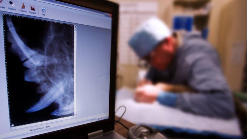 MIT, Temasa İhtiyaç Duymayan Yeni Bir Lazer Ultrason Teknolojisi Geliştirdi