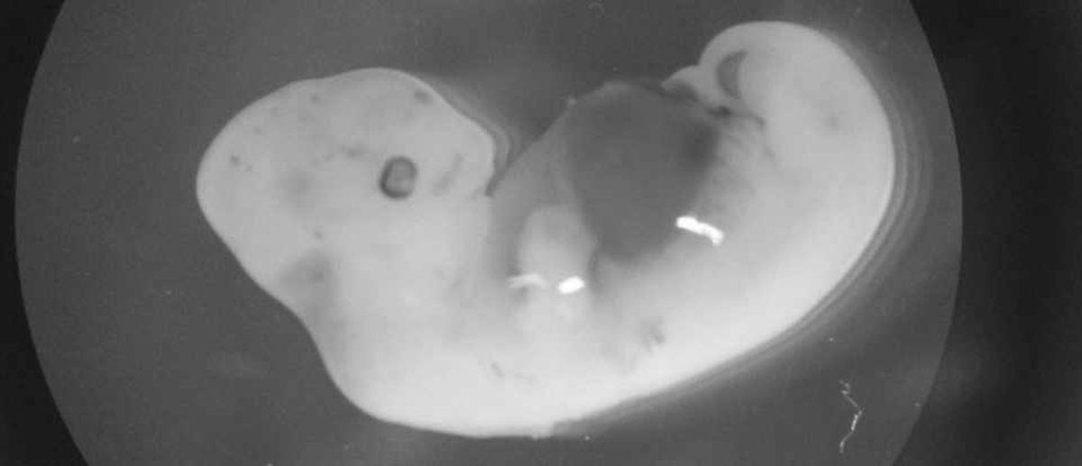 Bilim İnsanları, Organ Naklinde Çığır Açabilecek Bir Gelişmeye İmza Attı