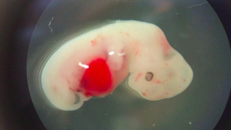 Bilim İnsanları, Organ Naklinde Çığır Açabilecek Bir Gelişmeye İmza Attı