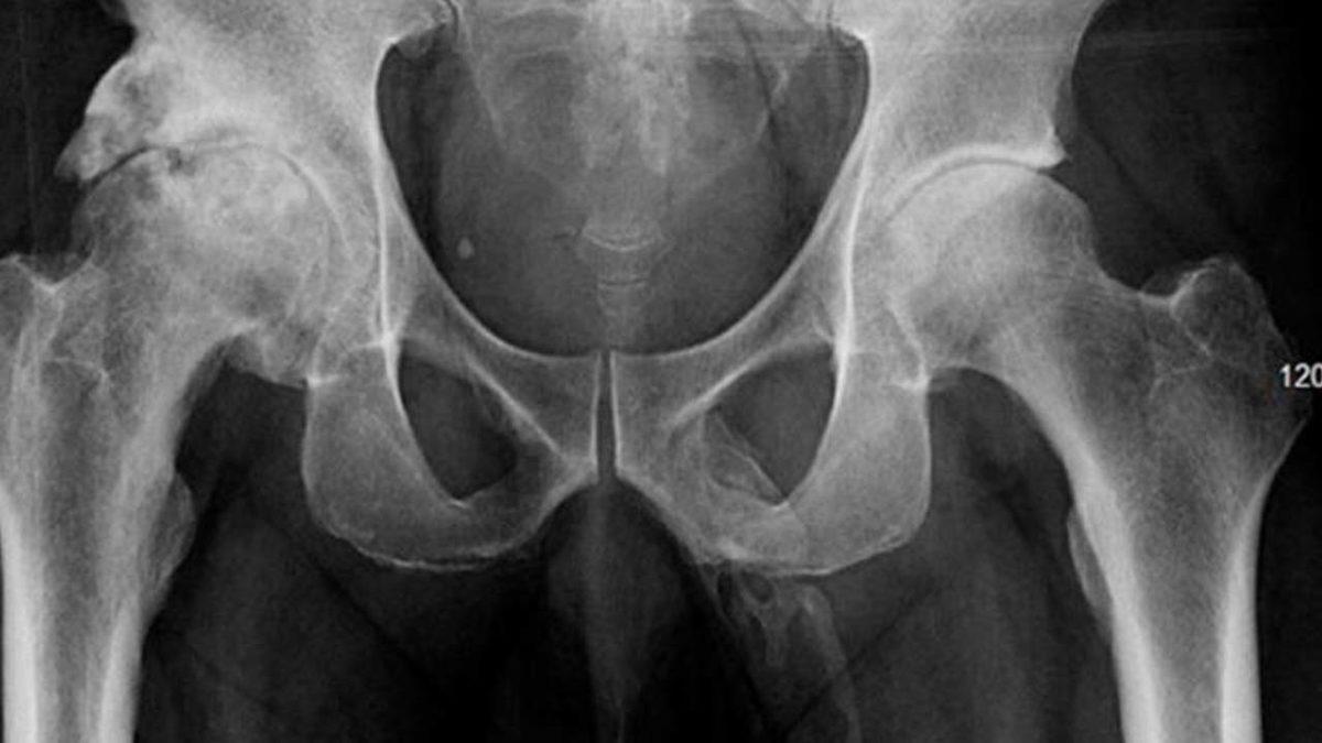 2019’da Görülen En İlginç 10 Medikal Vaka