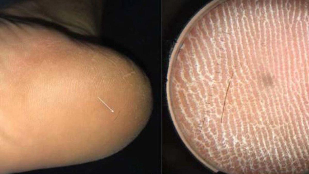 2019’da Görülen En İlginç 10 Medikal Vaka