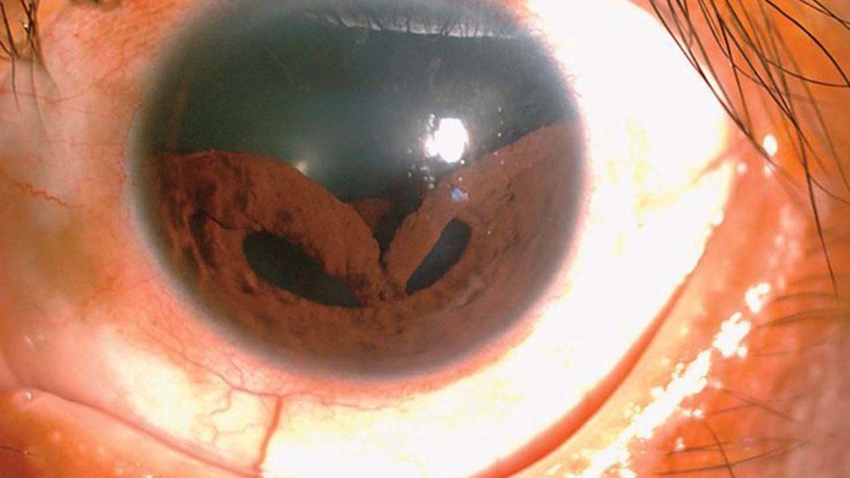 2019’da Görülen En İlginç 10 Medikal Vaka