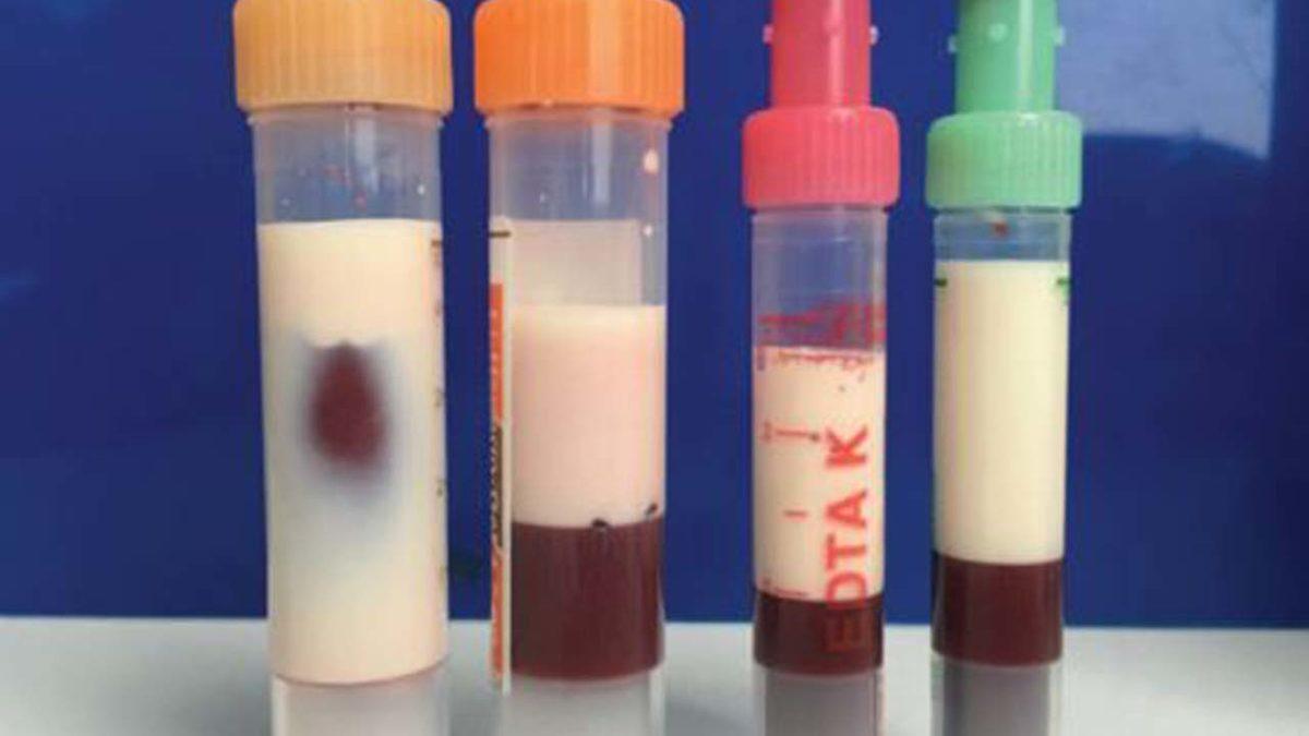 2019’da Görülen En İlginç 10 Medikal Vaka