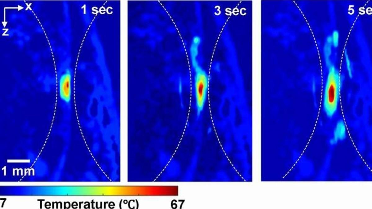 Derin Dokulardaki Isıyı Ölçebilecek Yeni Yöntem Geliştirildi