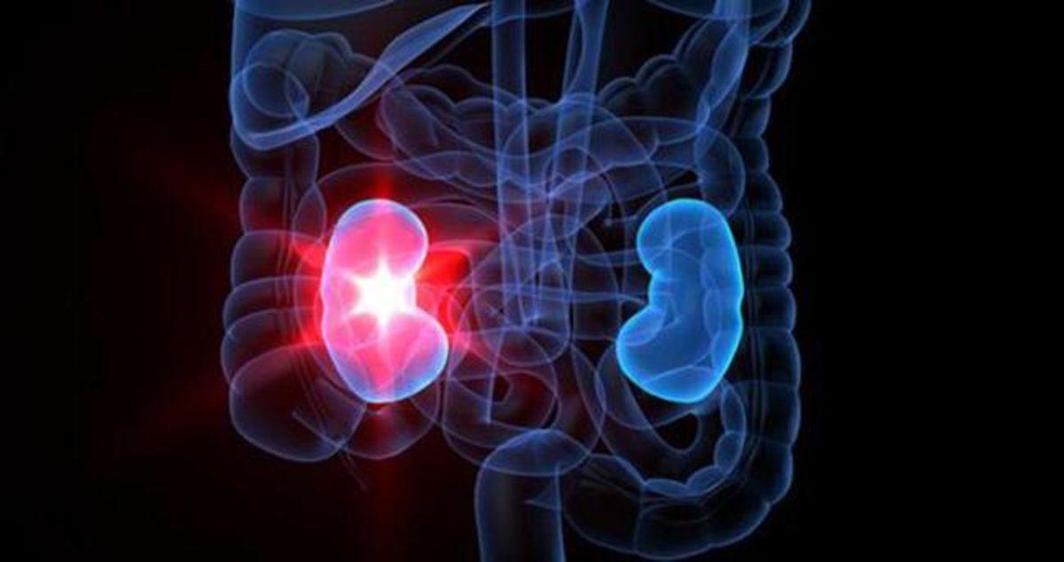 Tek Böbrekli Bireylerin Dikkat Etmeleri Gerekenler