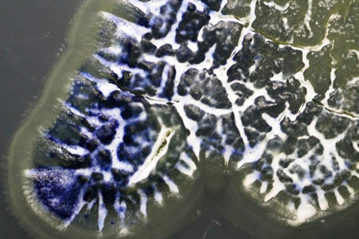 Böcekler, Antibiyotik Direncine Karşı Verilen Savaşta Bize Yardımcı Olabilir