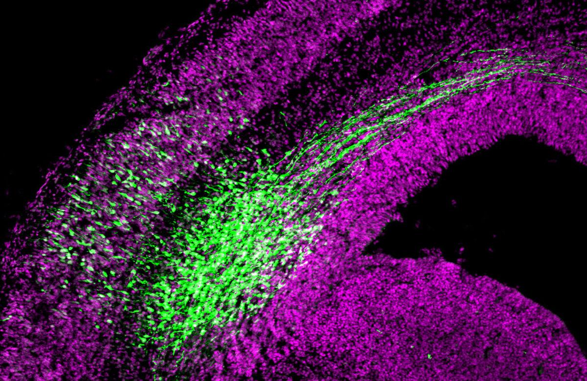 Bilim İnsanları, Nöral Kök Hücrelerini Düzenleyen Yeni Bir Mekanizma Keşfetti