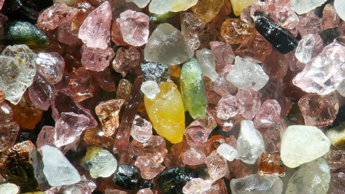 Dünyada En Çok Türkiye’de Görülen Hastalık: Alveoler Mikrolitiazis