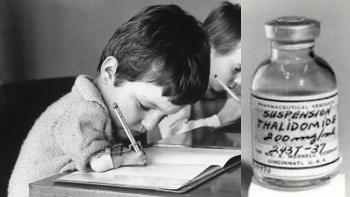 63 Yıl Önce, Binlerce Sakat Çocuğun Doğmasına Neden Olan İlaç: Talidomit (18+ Video)