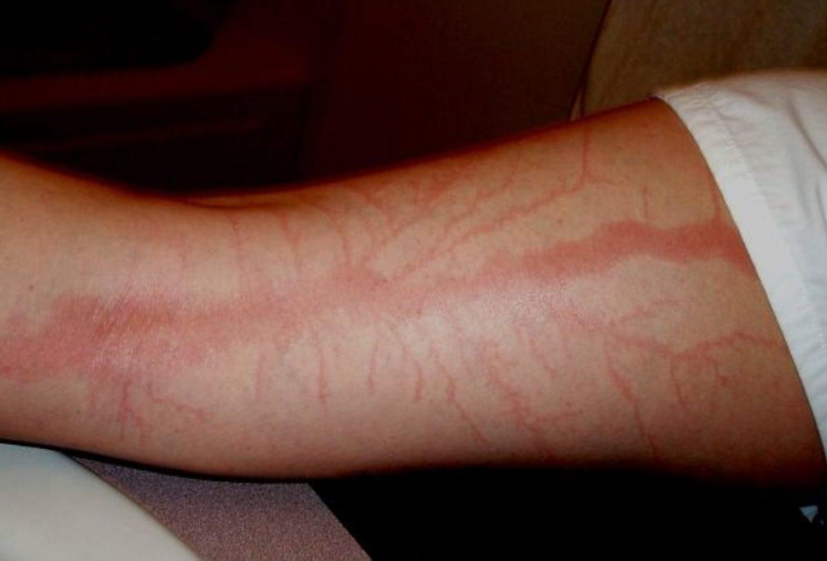 İnsan Vücudunun Hayrete Düşüren 42 Özelliği