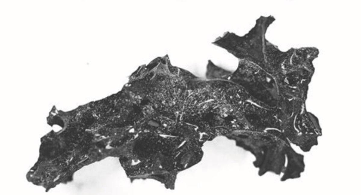 Vezüv Yanardağı’nın Patlaması, Bir Kurbanın Beynini Cama Dönüştürmüş