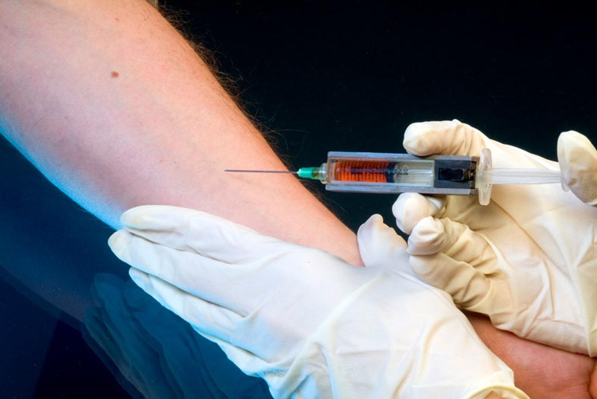 Sağlıklı Olmak İçin Vücuduna Şırıngayla Meyve Suyu Enjekte Eden Kadın Ölümden Döndü