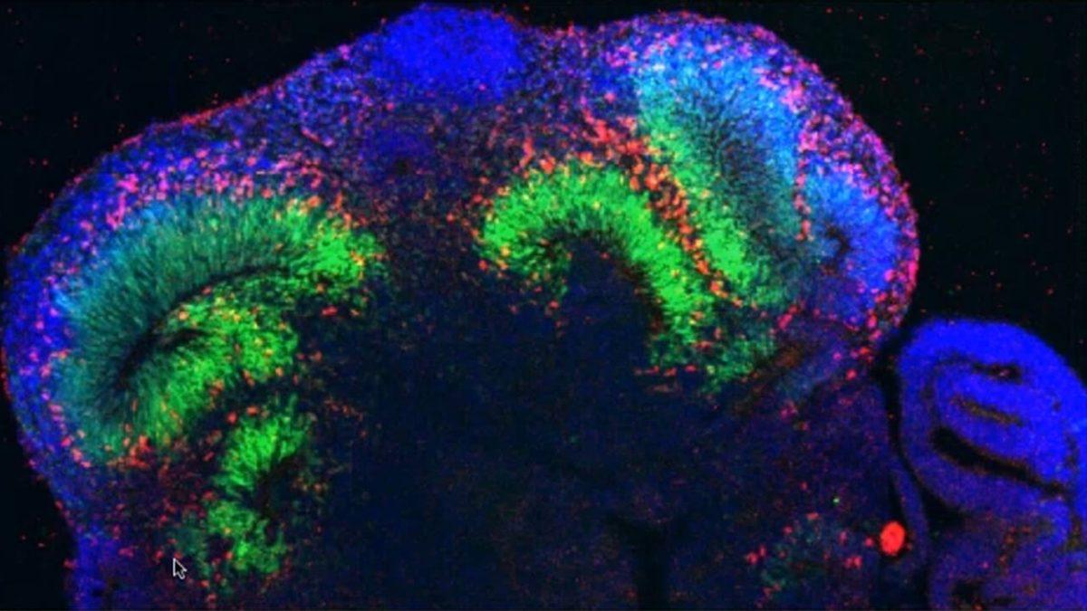 Sinirsel Aktivite Gerçekleştirebilen Bir Yapay Beyin Tasarlandı