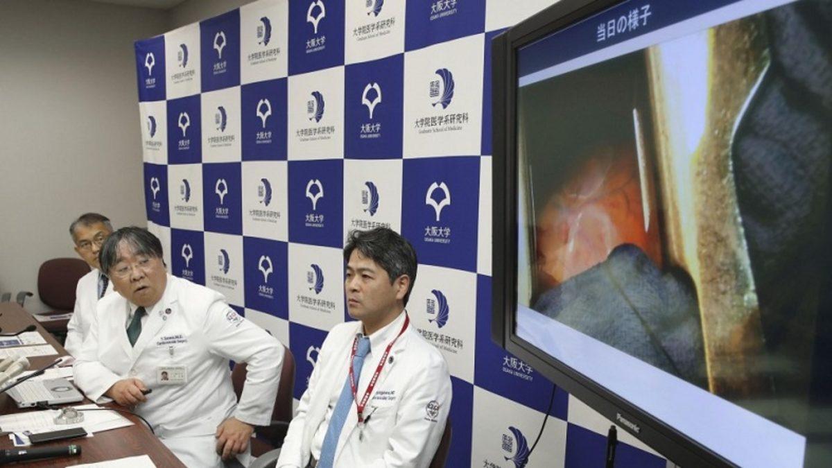 Bilim İnsanları, Kalp Nakline Alternatif Olabilecek Bir Doku Nakli Yöntemi Geliştirdi