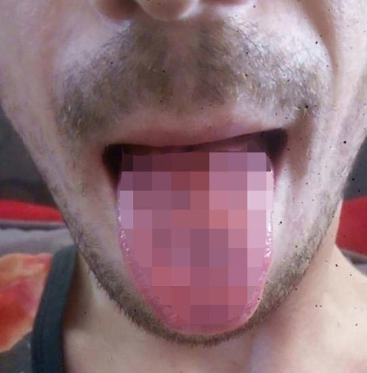 Günde Altı Kutu Enerji İçeceği İçen Bir Adamın Dili Eridi