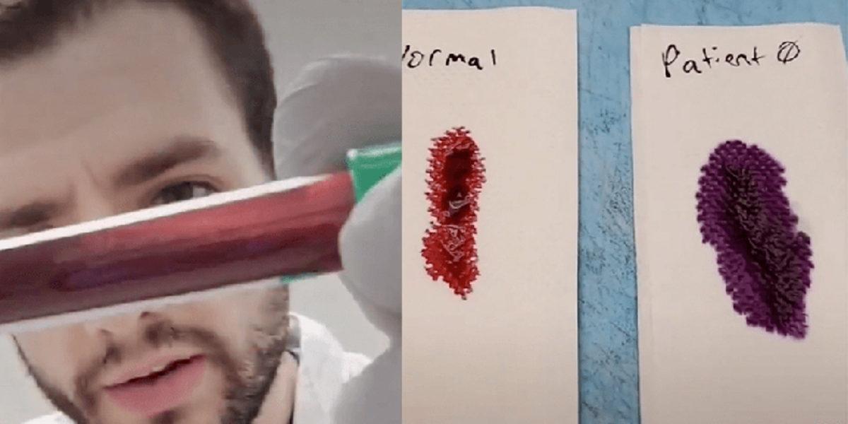 Corona Virüsü ile İlgili TikTok’ta Paylaşılan Sahte Video Tepki Çekti