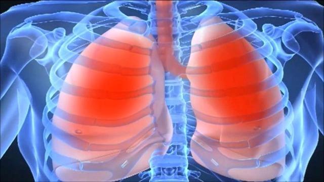 Bu Ücretsiz Yapay Zeka, Röntgen Filmlerini Doktorlar Kadar İyi Okuyabiliyor