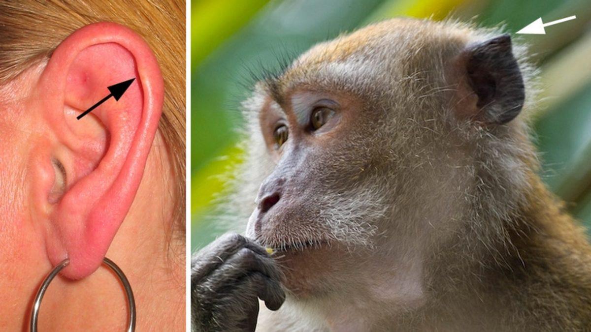 İnsan Vücudunda Bulunan 10 Körelmiş Organ ve Kas