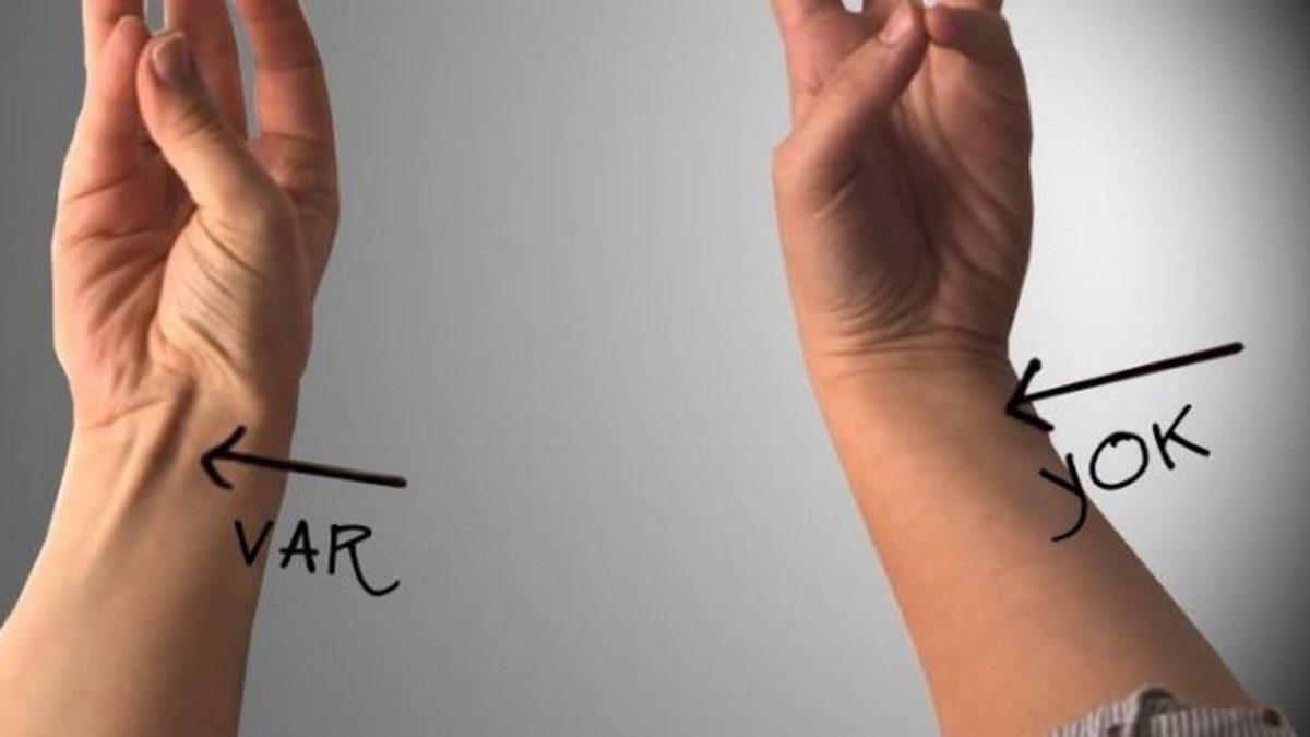 İnsan Vücudunda Bulunan 10 Körelmiş Organ ve Kas