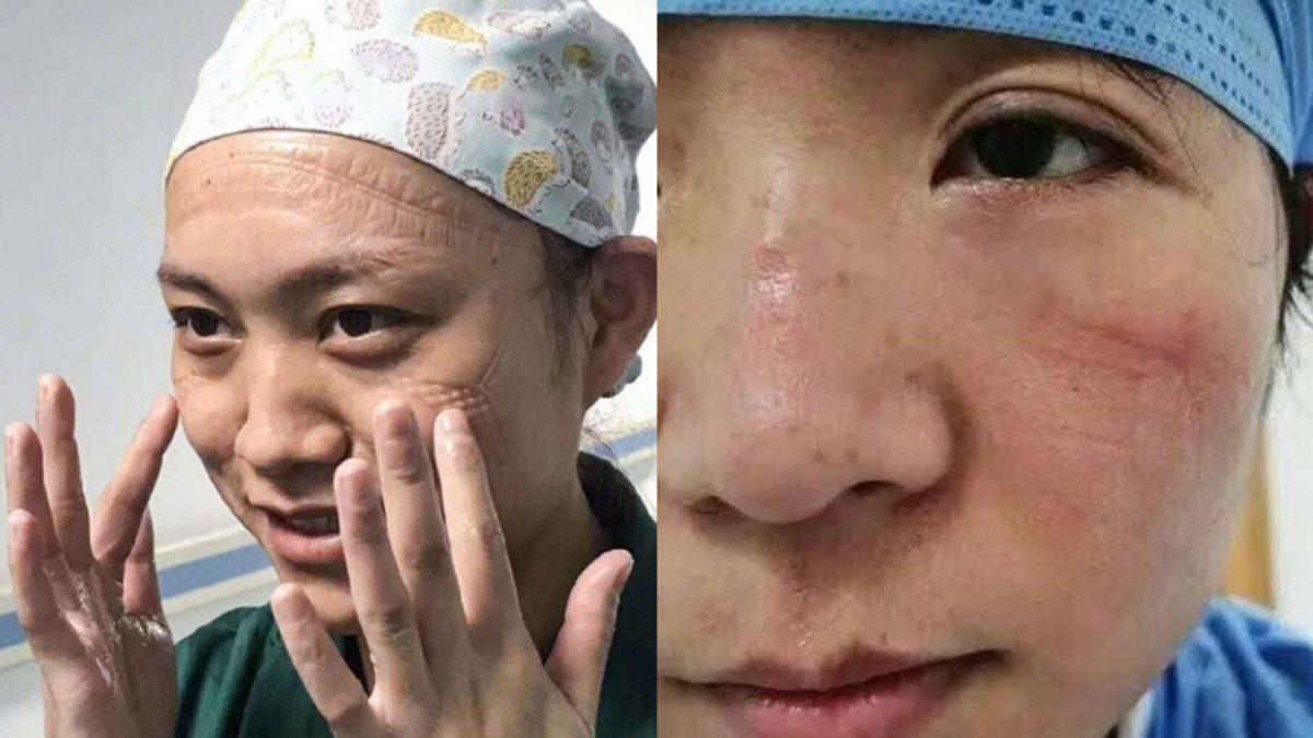 Çinli Doktorların Corona Virüsü ile Olan Fedakarca Mücadelesini Gösteren Fotoğraflar