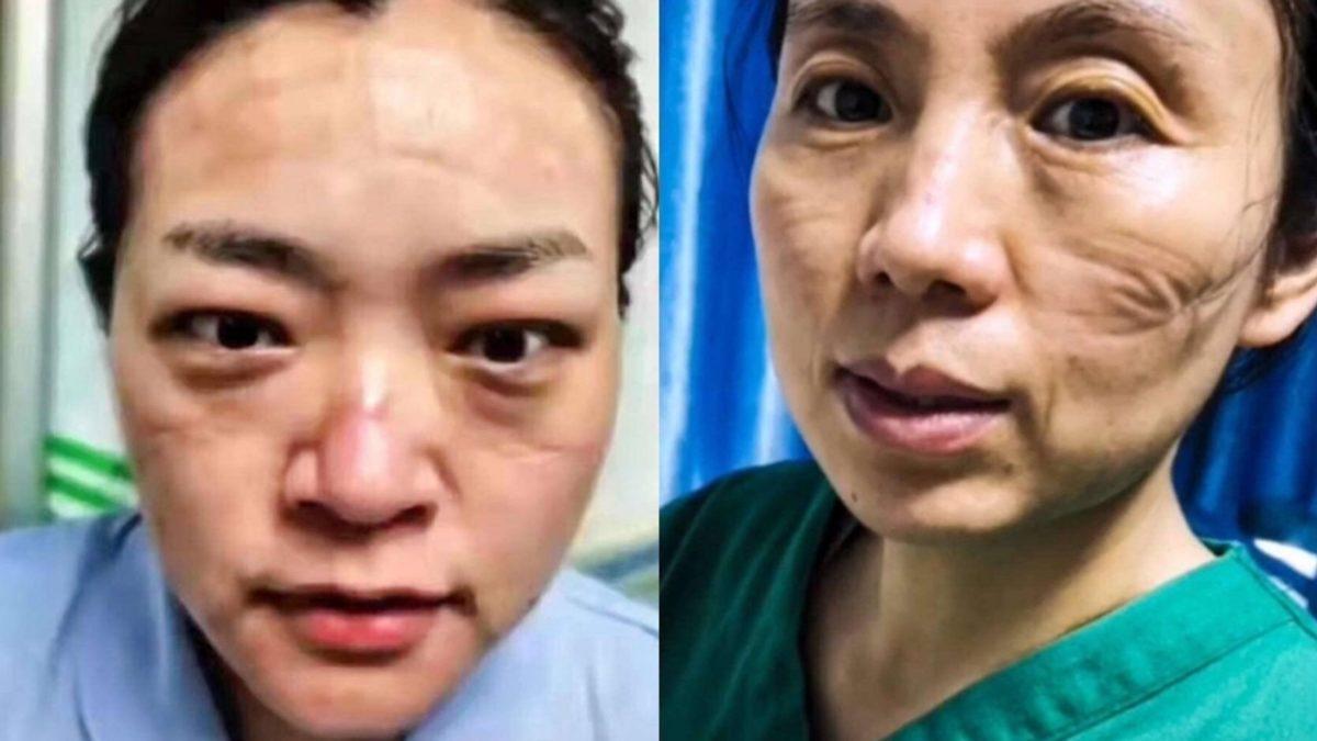 Çinli Doktorların Corona Virüsü ile Olan Fedakarca Mücadelesini Gösteren Fotoğraflar