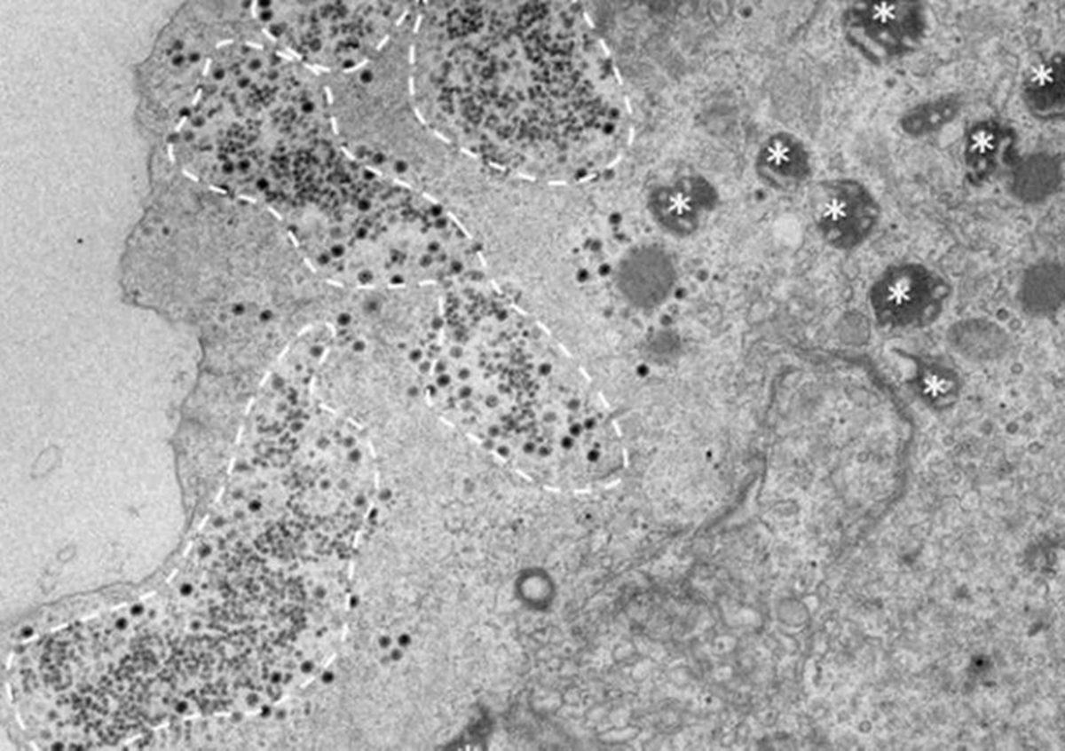 Daha Önce Gözlenmemiş Bir DNA Yapısına Sahip Virüs Keşfedildi