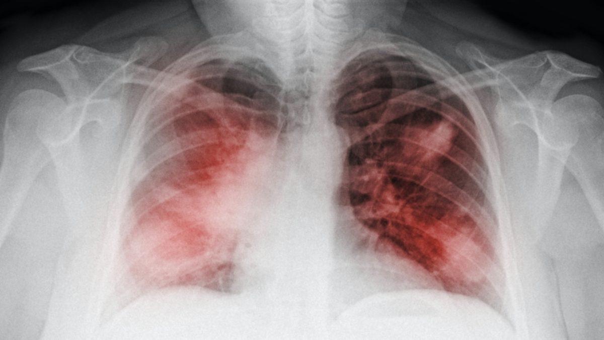 Türk Bilim İnsanı, Sepsis Hastalığını Birkaç Dakika İçinde Teşhis Edebilen Bir Cihaz Geliştirdi