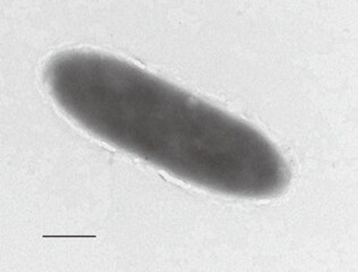 En Derin Okyanus Çukurunda Petrol Yiyen Bakteri Bulundu