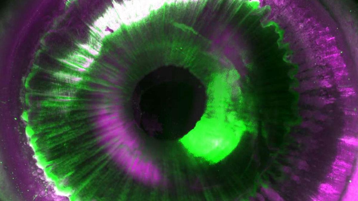 Bilim İnsanları, İnsan Organlarını İlk Kez Şeffaf Hâle Getirmeyi Başardı