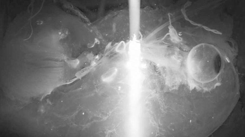 Bilim İnsanları, İnsan Organlarını İlk Kez Şeffaf Hâle Getirmeyi Başardı