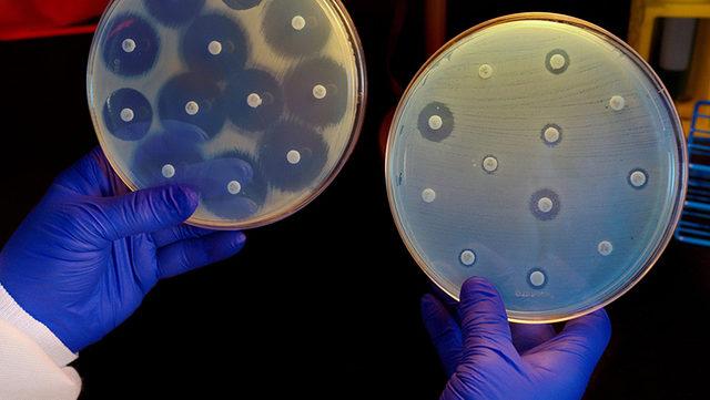 İlk Defa Makine Öğrenme Kullanılarak Bir Antibiyotik Geliştirildi