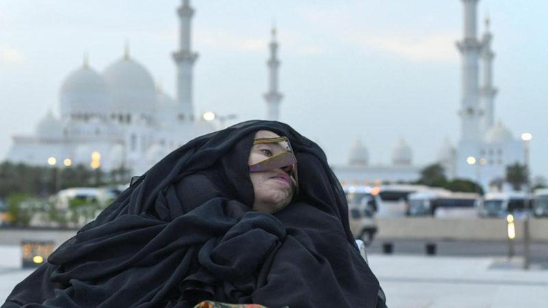 Geçirdiği Trafik Kazası Sonrası Komaya Giren Kadın, 27 Yıl Sonra Uyandı