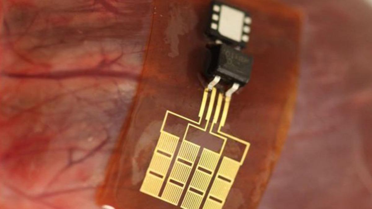 ABD Ve Çinli Araştırmacılar, ’Pilsiz Bir Kalp Pili’ Üzerine Çalışıyorlar