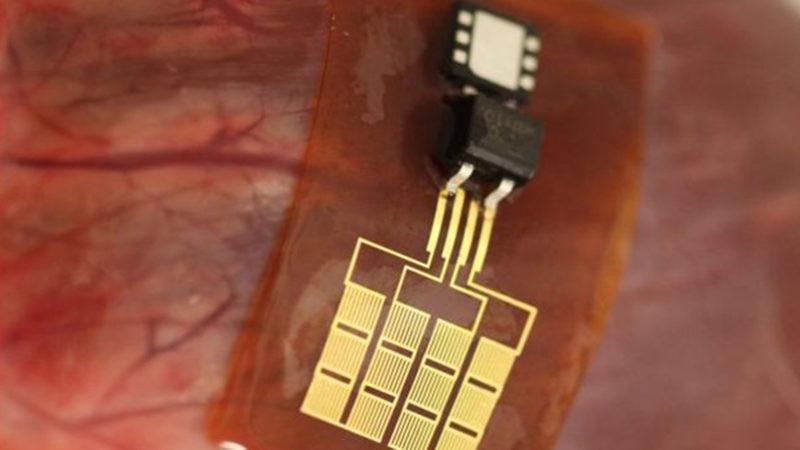 ABD Ve Çinli Araştırmacılar, ’Pilsiz Bir Kalp Pili’ Üzerine Çalışıyorlar