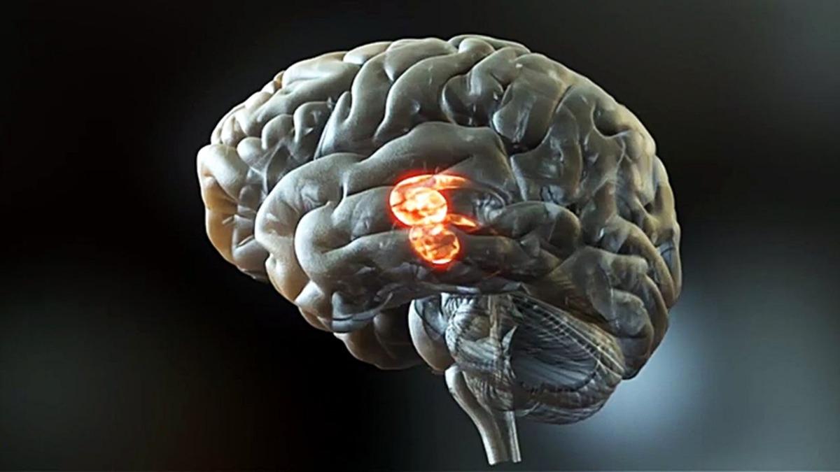 Bilim İnsanları, Beyin Sinyallerini Konuşma Sesine Çeviren Bir İmplant Geliştirdi