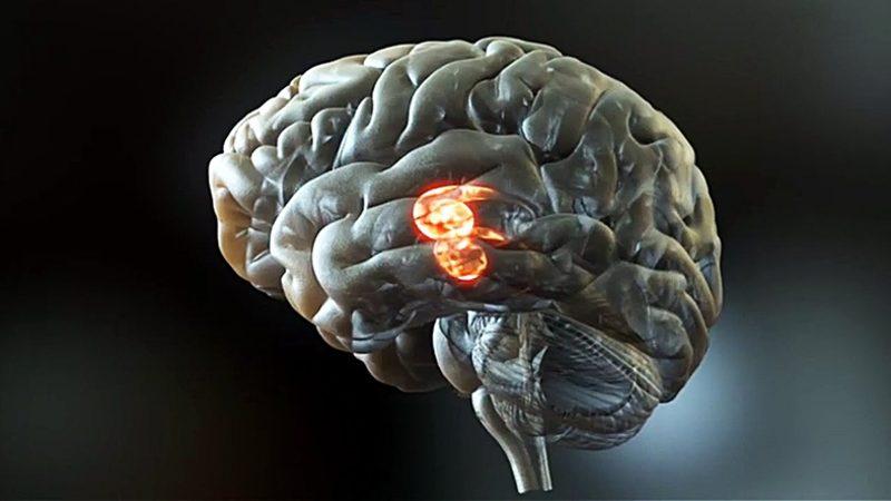 Bilim İnsanları, Beyin Sinyallerini Konuşma Sesine Çeviren Bir İmplant Geliştirdi