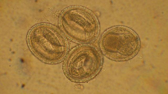 Bilim İnsanları, İpliksi Solucanları Kullanarak Kanseri Tespit Eden Bir Yöntem Geliştirdi