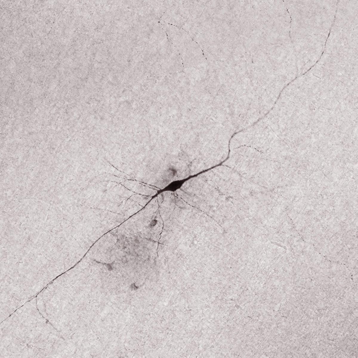 Araştırmacılar, Gizemli Bir Beyin Hücresinin Aktivitesini İlk Kez Kaydetti