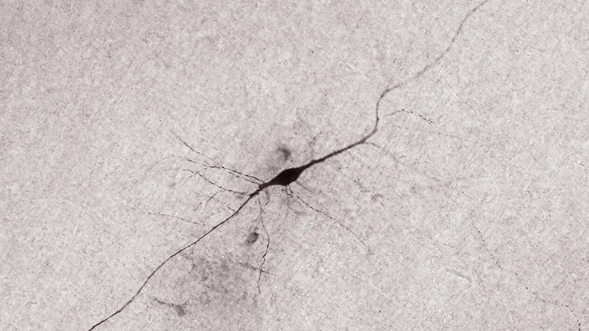 Araştırmacılar, Gizemli Bir Beyin Hücresinin Aktivitesini İlk Kez Kaydetti