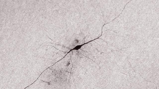 Araştırmacılar, Gizemli Bir Beyin Hücresinin Aktivitesini İlk Kez Kaydetti